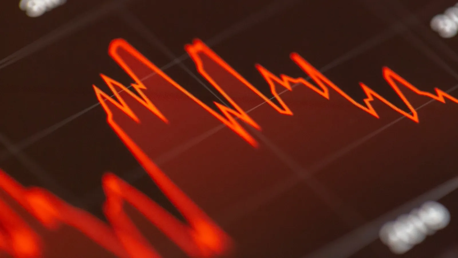 Bollinger Bands Explained: How the Indicator Works